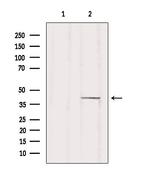 ZDHHC18 Polyclonal Antibody