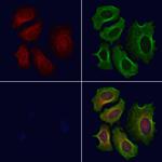 CROT Polyclonal Antibody