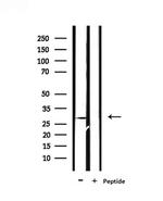 PEX11A Polyclonal Antibody