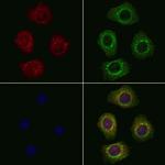 PEX6 Antibody in Immunocytochemistry (ICC/IF)