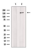 PREX1 Antibody in Western Blot (WB)
