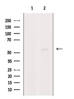 PIGA Polyclonal Antibody