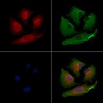 PIGP Polyclonal Antibody