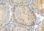 PIGP Antibody in Immunohistochemistry (Paraffin) (IHC (P))