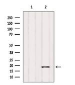 PIGP Antibody in Western Blot (WB)