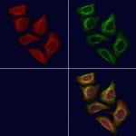 PIGQ Polyclonal Antibody