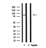 PIGQ Antibody in Western Blot (WB)