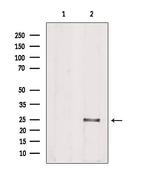 PIGF Polyclonal Antibody