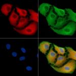 GPLD1 Polyclonal Antibody