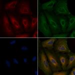 PIK3R6 Polyclonal Antibody