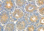 PIK3R6 Antibody in Immunohistochemistry (Paraffin) (IHC (P))