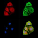 ATP2B1/2/3 Polyclonal Antibody