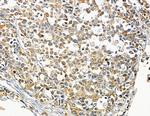 ATP2B1/2/3 Antibody in Immunohistochemistry (Paraffin) (IHC (P))