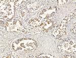 ATP2B1/2/3 Antibody in Immunohistochemistry (Paraffin) (IHC (P))