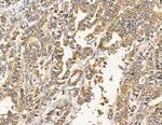 ATP2B1/2/3 Antibody in Immunohistochemistry (Paraffin) (IHC (P))