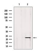 GP1BB Polyclonal Antibody