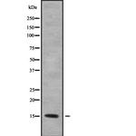 KCNE1L Antibody in Western Blot (WB)