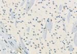 KCNE3 Polyclonal Antibody