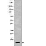 PART1 Antibody in Western Blot (WB)