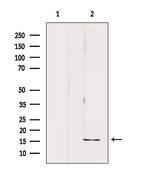 PP14B Antibody in Western Blot (WB)