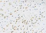 PPP1R1C Antibody in Immunohistochemistry (Paraffin) (IHC (P))