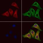 PPP1R2P3 Antibody in Immunocytochemistry (ICC/IF)