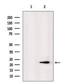 PPP1R2P3 Antibody in Western Blot (WB)