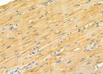 S100A7A Antibody in Immunohistochemistry (Paraffin) (IHC (P))