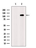 SUGP2 Polyclonal Antibody