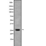 C5orf26 Antibody in Western Blot (WB)