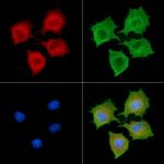 RABL2B Antibody in Immunocytochemistry (ICC/IF)