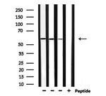 RASGEF1B Polyclonal Antibody