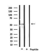 RASGEF1C Antibody in Western Blot (WB)