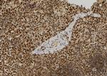 RERG Antibody in Immunohistochemistry (Paraffin) (IHC (P))