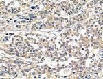 RERG Antibody in Immunohistochemistry (Paraffin) (IHC (P))