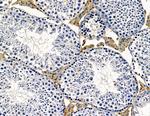 RERG Antibody in Immunohistochemistry (Paraffin) (IHC (P))