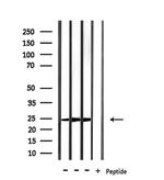 RAB15 Antibody in Western Blot (WB)