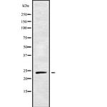 RAB21 Antibody in Western Blot (WB)