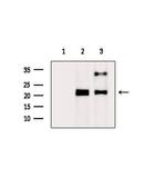 RAB22A Polyclonal Antibody