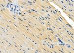 RAB28 Polyclonal Antibody