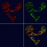 RAB30 Polyclonal Antibody