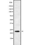 RAB30 Antibody in Western Blot (WB)
