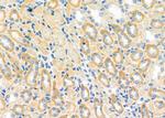 RAB32 Polyclonal Antibody