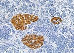 RAB40AL Antibody in Immunohistochemistry (Paraffin) (IHC (P))