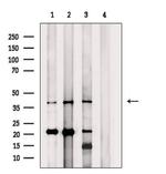 RAB40C Antibody in Western Blot (WB)