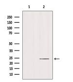RAB6B Polyclonal Antibody