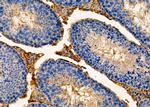 RAB8B Antibody in Immunohistochemistry (Paraffin) (IHC (P))