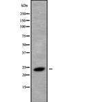 RAB8B Antibody in Western Blot (WB)