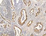 RRAS2 Polyclonal Antibody
