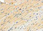 PTPRB Antibody in Immunohistochemistry (Paraffin) (IHC (P))